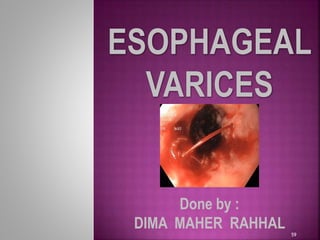 59
Done by :
DIMA MAHER RAHHAL
 