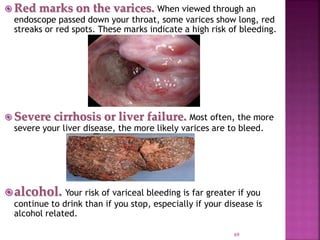  Red marks on the varices. When viewed through an
endoscope passed down your throat, some varices show long, red
streaks or red spots. These marks indicate a high risk of bleeding.
 Severe cirrhosis or liver failure. Most often, the more
severe your liver disease, the more likely varices are to bleed.
alcohol. Your risk of variceal bleeding is far greater if you
continue to drink than if you stop, especially if your disease is
alcohol related.
69
 