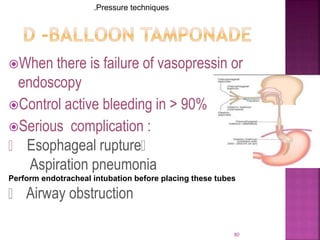 When there is failure of vasopressin or
endoscopy
Control active bleeding in > 90%
Serious complication :
Esophageal rupture
Aspiration pneumonia
Perform endotracheal intubation before placing these tubes
Airway obstruction
80
.Pressure techniques
 