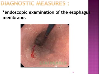 *endoscopic examination of the esophagus
membrane.
90
 
