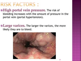 High portal vein pressure. The risk of
bleeding increases with the amount of pressure in the
portal vein (portal hypertension).
Large varices. The larger the varices, the more
likely they are to bleed.
68
 