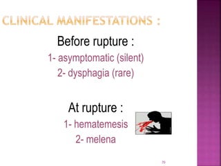 Before rupture :
1- asymptomatic (silent)
2- dysphagia (rare)
At rupture :
1- hematemesis
2- melena
70
 