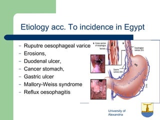 University of
Alexandria
Etiology acc. To incidence in Egypt
– Ruputre oesophageal varice
– Erosions,
– Duodenal ulcer,
– Cancer stomach,
– Gastric ulcer
– Mallory-Weiss syndrome
– Reflux oesophagitis
 