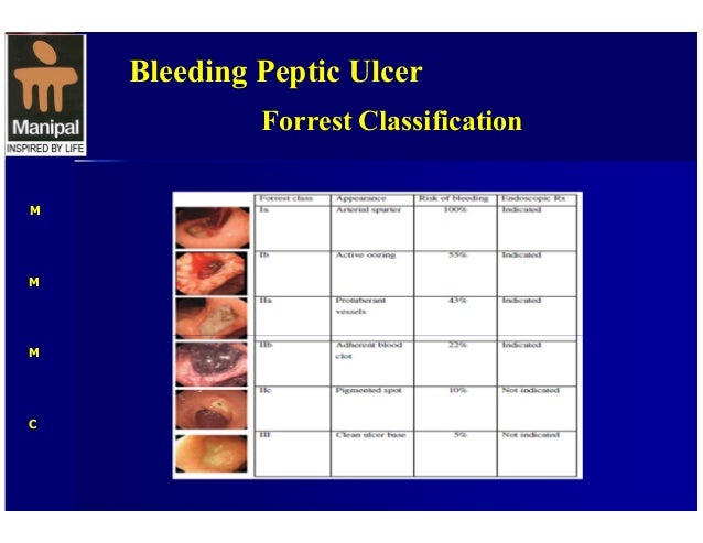 classification of peptic ulcer pdf