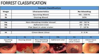 FORREST CLASSIFICATION
 