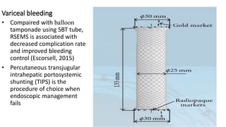 Variceal bleeding
• Compaired with balloon
tamponade using SBT tube,
RSEMS is associated with
decreased complication rate
and improved bleeding
control (Escorsell, 2015)
• Percutaneous transjugular
intrahepatic portosystemic
shunting (TIPS) is the
procedure of choice when
endoscopic management
fails
 