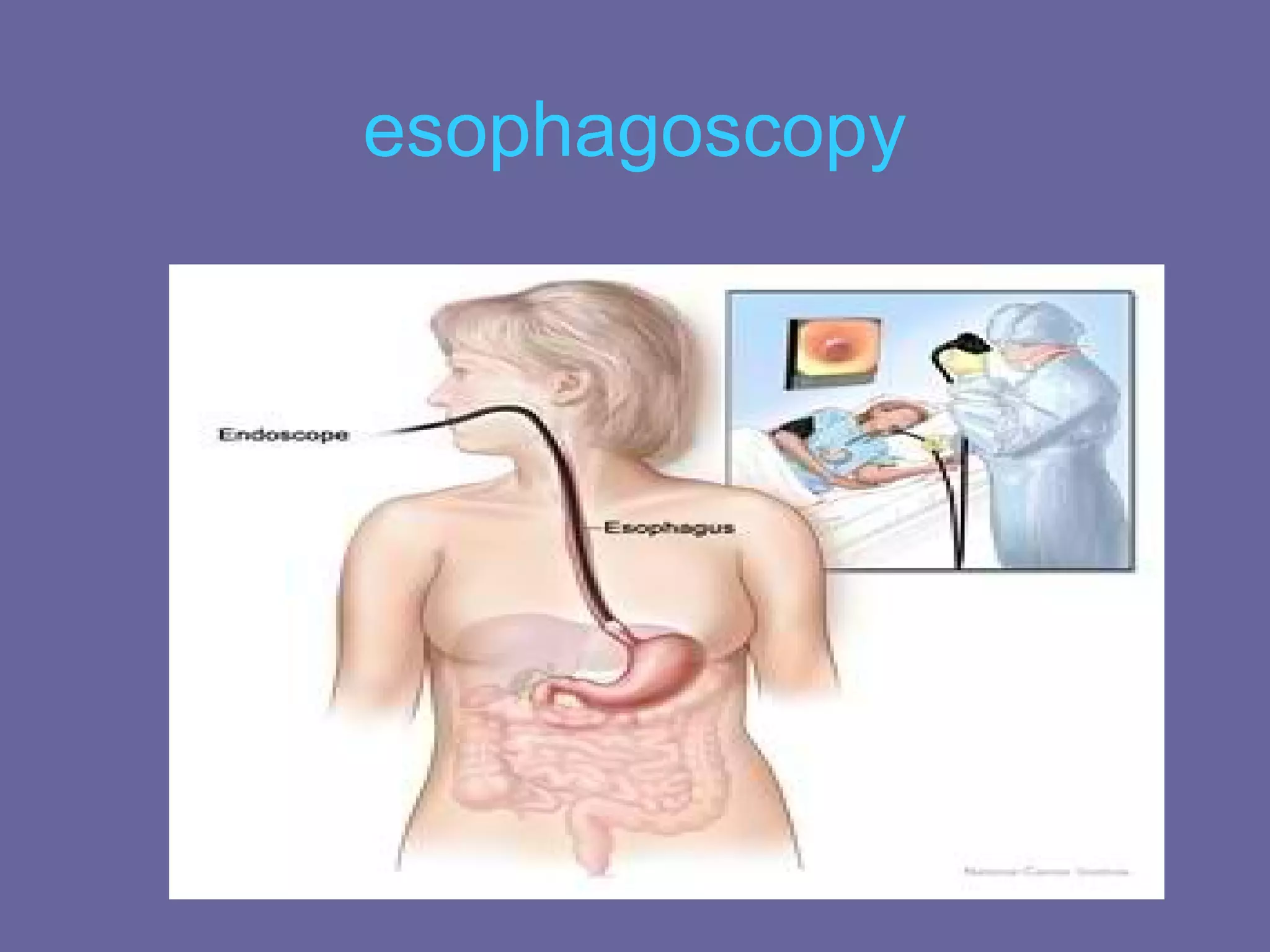 esophagoscopy
 