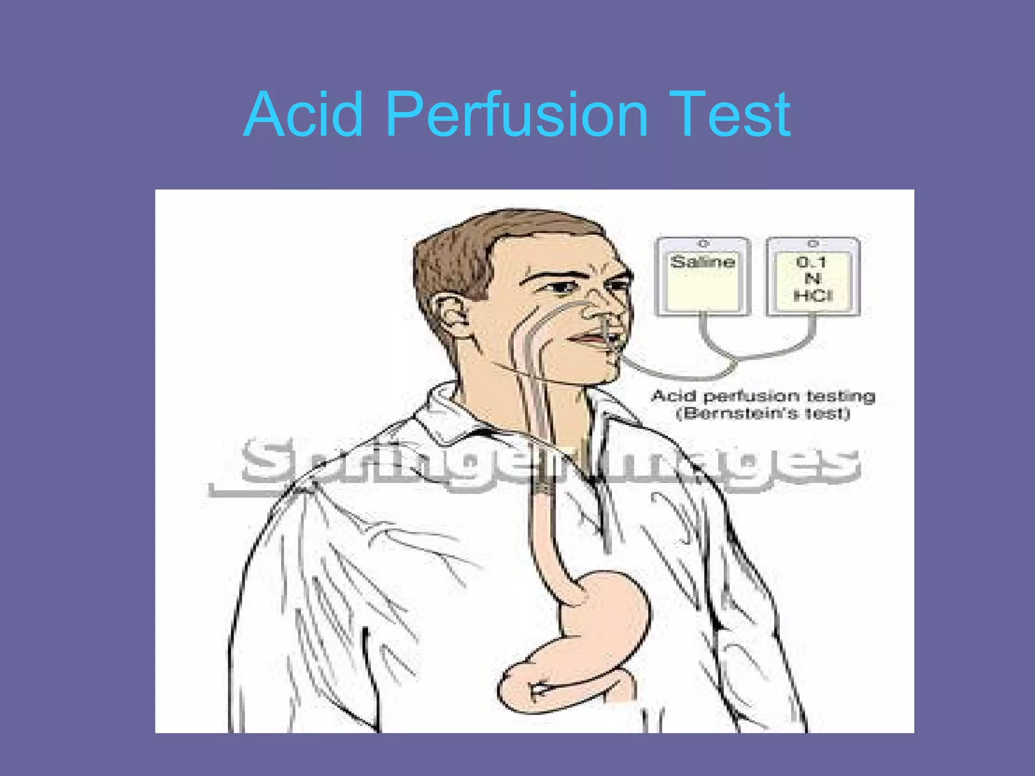Acid Perfusion Test
 