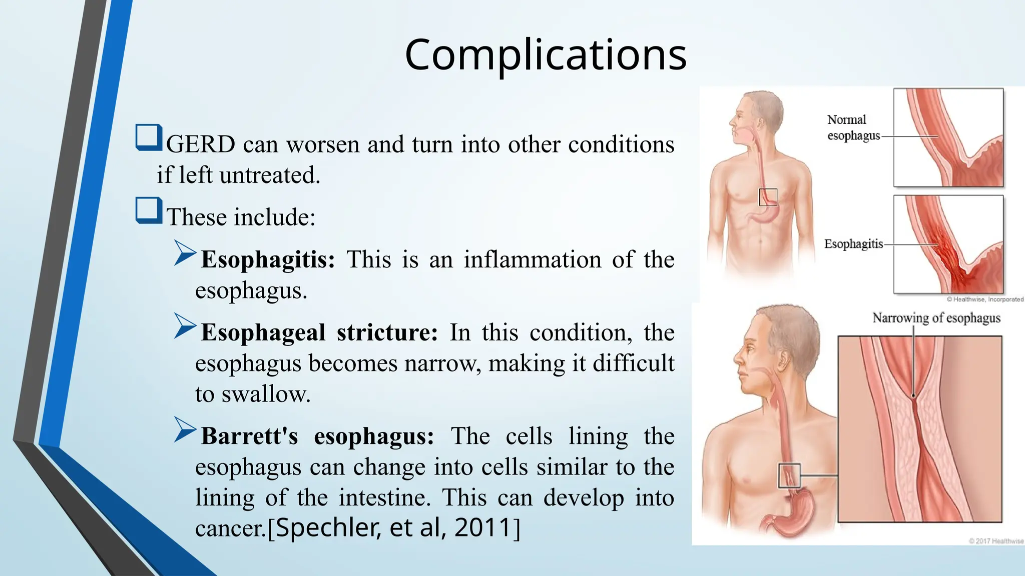 Complications
GERD can worsen and turn into other conditions
if left untreated.
These include:
Esophagitis: This is an inflammation of the
esophagus.
Esophageal stricture: In this condition, the
esophagus becomes narrow, making it difficult
to swallow.
Barrett's esophagus: The cells lining the
esophagus can change into cells similar to the
lining of the intestine. This can develop into
cancer.[Spechler, et al, 2011]
 