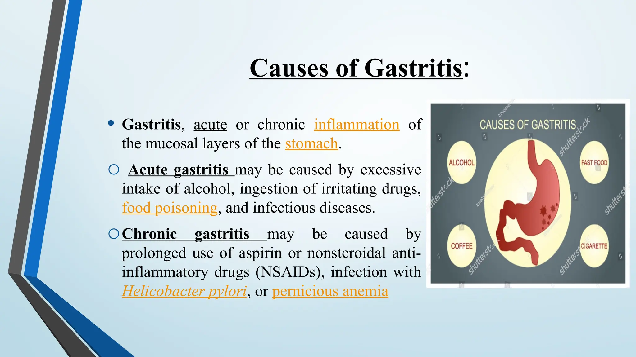 Causes of Gastritis:
• Gastritis, acute or chronic inflammation of
the mucosal layers of the stomach.
o Acute gastritis may be caused by excessive
intake of alcohol, ingestion of irritating drugs,
food poisoning, and infectious diseases.
oChronic gastritis may be caused by
prolonged use of aspirin or nonsteroidal anti-
inflammatory drugs (NSAIDs), infection with
Helicobacter pylori, or pernicious anemia
 