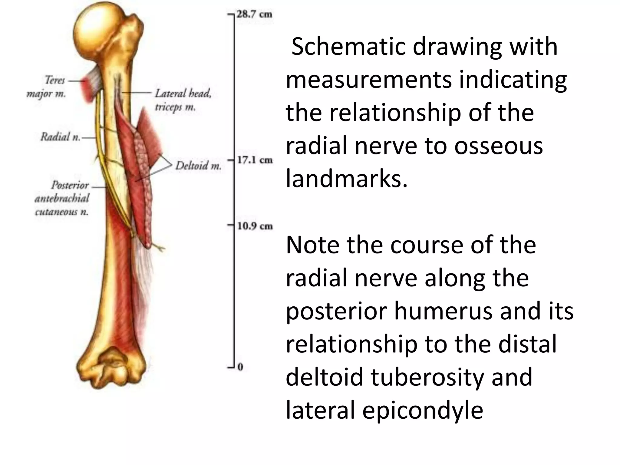 Schematic drawing with
measurements indicating
the relationship of the
radial nerve to osseous
landmarks.

Note the course of the
radial nerve along the
posterior humerus and its
relationship to the distal
deltoid tuberosity and
lateral epicondyle
 