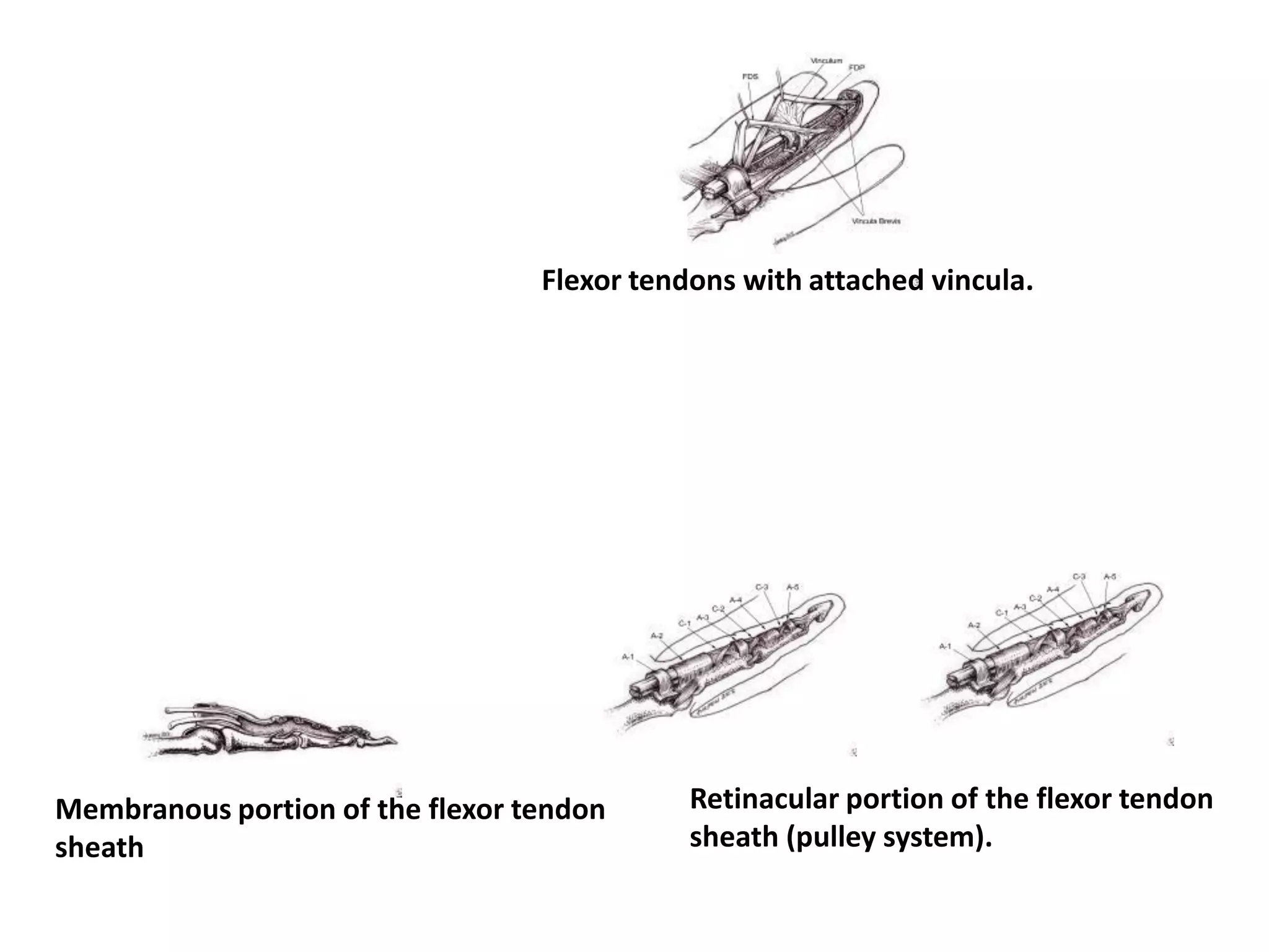 Flexor tendons with attached vincula.




Membranous portion of the flexor tendon      Retinacular portion of the flexor tendon
sheath                                       sheath (pulley system).
 