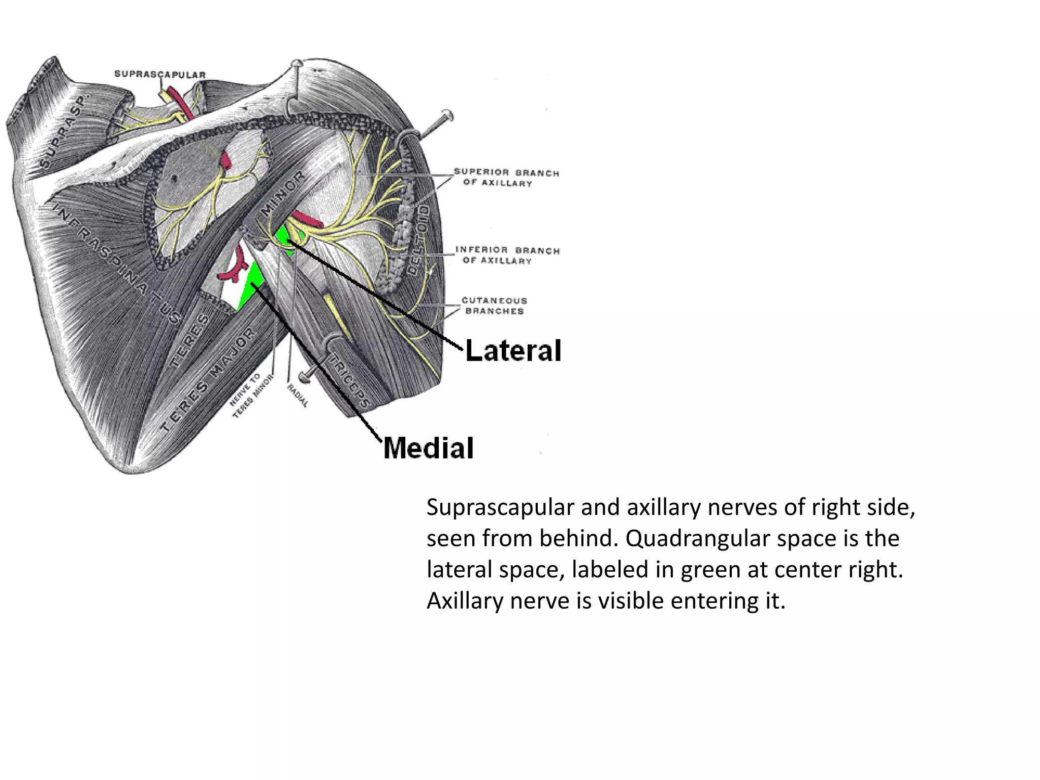 Suprascapular and axillary nerves of right side,
seen from behind. Quadrangular space is the
lateral space, labeled in green at center right.
Axillary nerve is visible entering it.
 