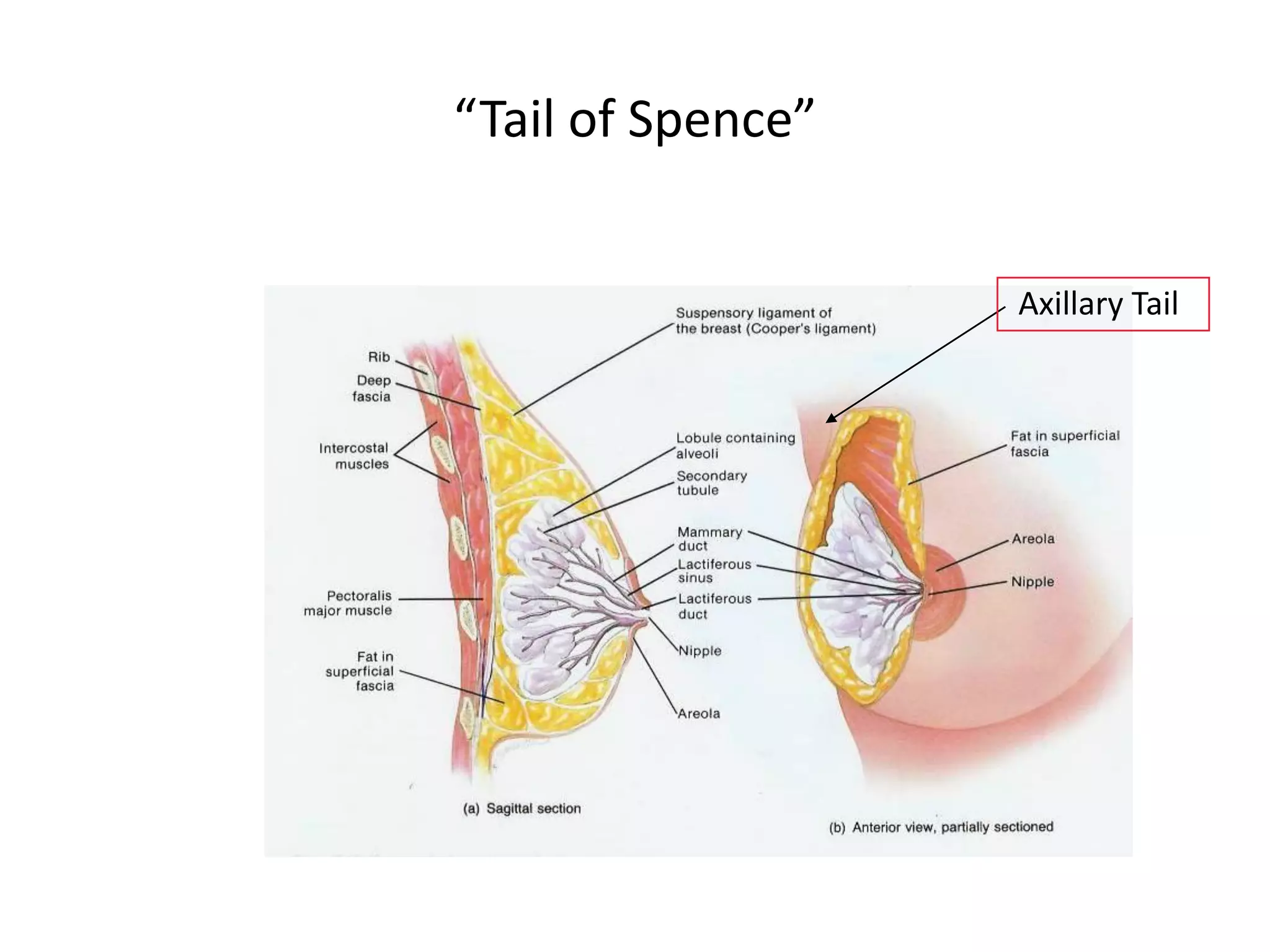 “Tail of Spence”


                   Axillary Tail
 