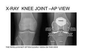 Upper Limb | PPTX