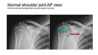 Upper Limb | PPTX