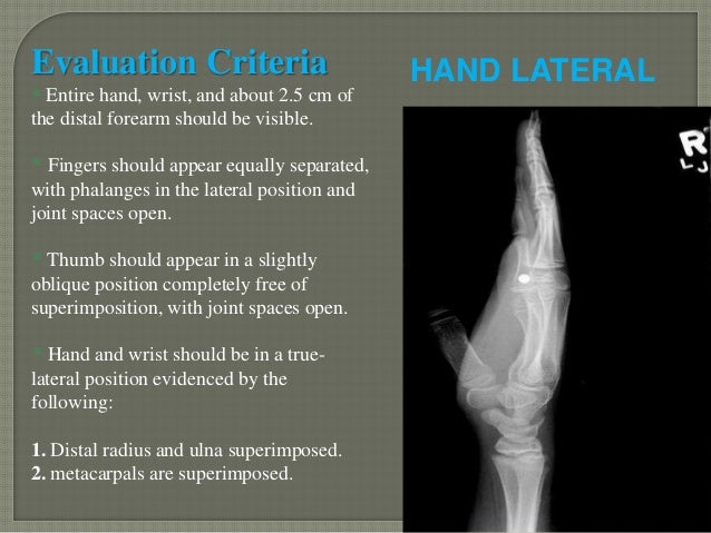 Upper Limb