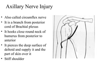 upper limb, injuries of the upper limb, detailed | PPTX