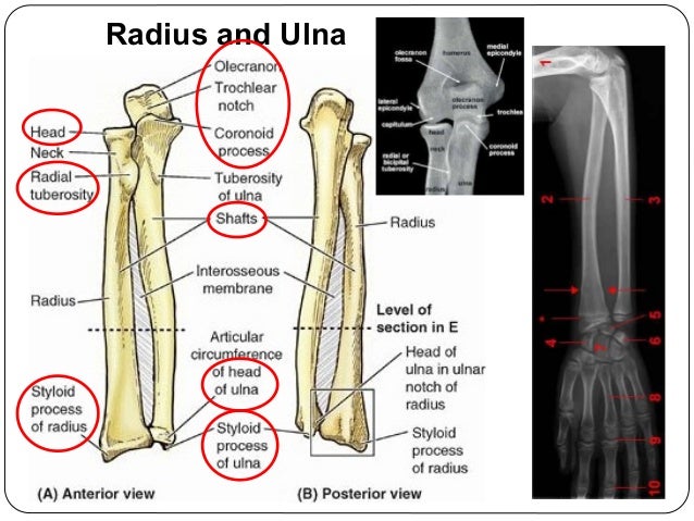 Upper limb bones-joints-muscles-Dr.B.B.Gosai