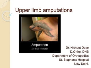 Upper limb amputations
Dr. Nisheet Dave
D.Ortho, DNB
Department of Orthopedics
St. Stephen’s Hospital
New Delhi.
 