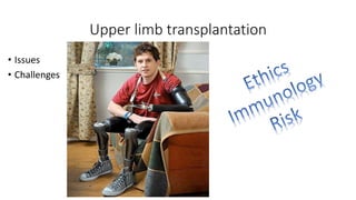 Upper limb transplantation
• Issues
• Challenges
 