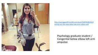 Psychology graduate student /
Congenital below elbow left arm
amputee
http://aannggeellll.tumblr.com/post/56878186543/t
esting-out-the-new-deka-luke-arm-videos-will
 