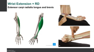 Wrist Extension + RD
Extensor carpi radialis longus and brevis
28
 