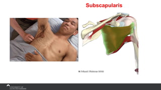 Subscapularis
 
