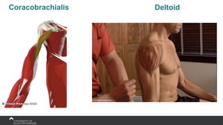 Coracobrachialis Deltoid
 