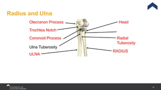 79
Radius and Ulna
Head
Radial
Tuberosity
RADIUS
Ulna Tuberosity
Coronoid Process
Olecranon Process
Trochlea Notch
ULNA
 