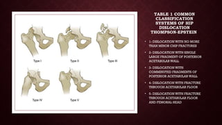 Upper and lower limbs dislocation by orthopaedics team.pptx