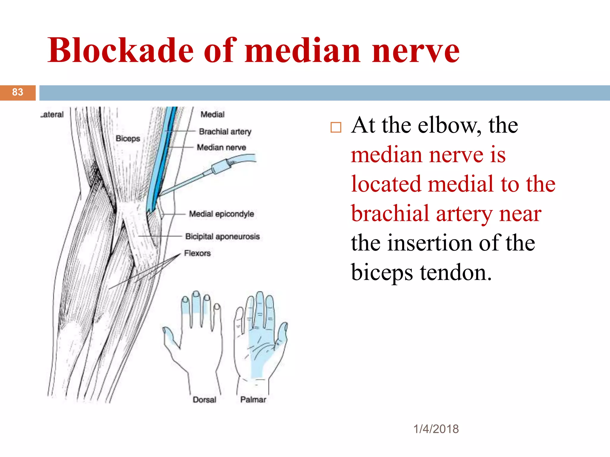Blockade of median nerve
 At the elbow, the
median nerve is
located medial to the
brachial artery near
the insertion of the
biceps tendon.
1/4/2018
83
 