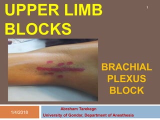 UPPER LIMB
BLOCKS
BRACHIAL
PLEXUS
BLOCK
Abraham Tarekegn
University of Gondar, Department of Anesthesia
1/4/2018
1
 