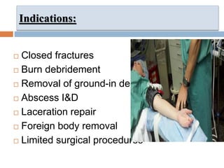 Indications:
 Closed fractures
 Burn debridement
 Removal of ground-in debris
 Abscess I&D
 Laceration repair
 Foreign body removal
 Limited surgical procedures
 