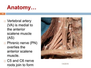 Anatomy…
 Vertebral artery
(VA) is medial to
the anterior
scalene muscle
(AS)
 Phrenic nerve (PN)
overlies the
anterior scalene
muscle.
 C5 and C6 nerve
roots join to form 1/4/2018
19
 