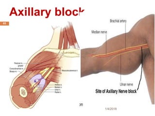 Axillary block
1/4/2018
65
 