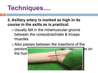 Techniques....
1/4/2018
68
2. Axillary artery is marked as high in its
course in the axilla as is practical.
 Usually felt in the intramuscular groove
between the coracobrachialis & triceps
muscles
 Also passes between the insertions of the
pectoralis major & latissimus dorsi muscles on
the humerus.
 