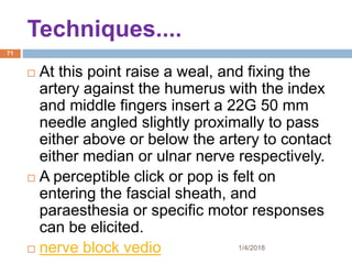 1/4/2018
71
 At this point raise a weal, and fixing the
artery against the humerus with the index
and middle fingers insert a 22G 50 mm
needle angled slightly proximally to pass
either above or below the artery to contact
either median or ulnar nerve respectively.
 A perceptible click or pop is felt on
entering the fascial sheath, and
paraesthesia or specific motor responses
can be elicited.
 nerve block vedio
Techniques....
 