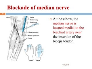 Blockade of median nerve
 At the elbow, the
median nerve is
located medial to the
brachial artery near
the insertion of the
biceps tendon.
1/4/2018
83
 