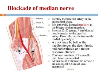Blockade of median nerve
 Identify the brachial artery in the
antecubital space.
 It is generally located medially, at
the biceps tendon insertion.
 Insert a 22-27 gauge, 4 cm blunted
needle medial to the brachial
artery. Direct the needle toward the
medial epicondyle.
 A click may be felt as the
needle pierces the deep fascia,
and paraesthesia or a motor
response elicited.
 Continue insertion of the needle
until bone is contacted.
 At this point withdraw the needle 1
cm and inject 3-5 ml of local
anesthetic.
1/4/2018
84
 