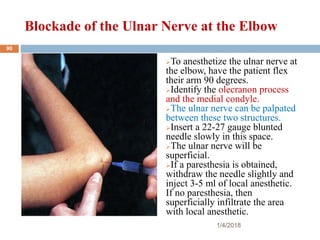 Blockade of the Ulnar Nerve at the Elbow
To anesthetize the ulnar nerve at
the elbow, have the patient flex
their arm 90 degrees.
Identify the olecranon process
and the medial condyle.
The ulnar nerve can be palpated
between these two structures.
Insert a 22-27 gauge blunted
needle slowly in this space.
The ulnar nerve will be
superficial.
If a paresthesia is obtained,
withdraw the needle slightly and
inject 3-5 ml of local anesthetic.
If no paresthesia, then
superficially infiltrate the area
with local anesthetic.
1/4/2018
90
 