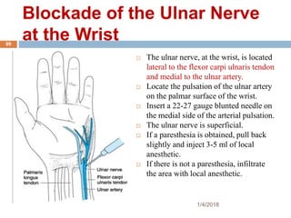 Blockade of the Ulnar Nerve
at the Wrist
 The ulnar nerve, at the wrist, is located
lateral to the flexor carpi ulnaris tendon
and medial to the ulnar artery.
 Locate the pulsation of the ulnar artery
on the palmar surface of the wrist.
 Insert a 22-27 gauge blunted needle on
the medial side of the arterial pulsation.
 The ulnar nerve is superficial.
 If a paresthesia is obtained, pull back
slightly and inject 3-5 ml of local
anesthetic.
 If there is not a paresthesia, infiltrate
the area with local anesthetic.
1/4/2018
99
 