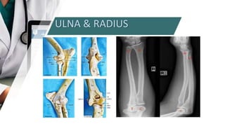 ULNA & RADIUS
 