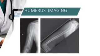 HUMERUS IMAGING
 