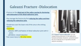 Upper limb fractures | PPTX