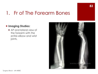 Fractures and Dislocations of Upper Limb | PPTX