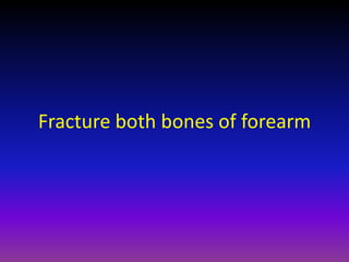 Fracture both bones of forearm
 