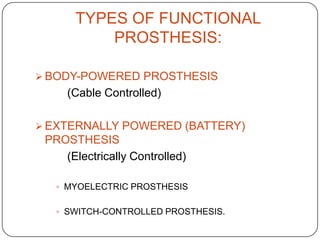 CONSIDERATIONS WHEN CHOOSING A PROSTHESIS: Amputation level
