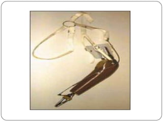 Expected function of the Prosthesis