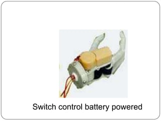 Financial resources of the Patient.Reasons for an Upper Limb Amputations:THIS IS MOSTLY CORRELATED BY AGE.(0-15 years) CONGENITAL DEFORMITY OR TUMOR